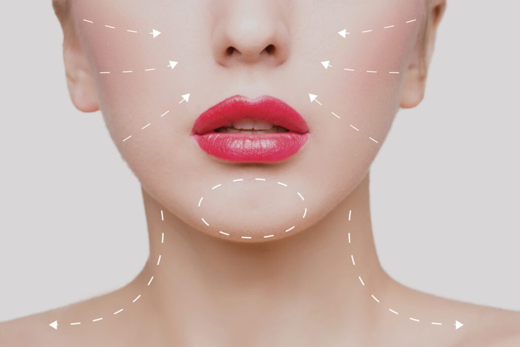 Botox spot