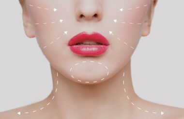 Botox spot