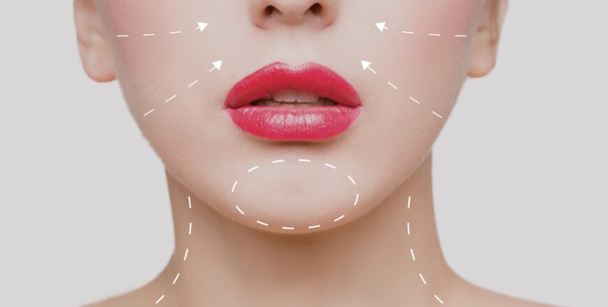 Botox spot
