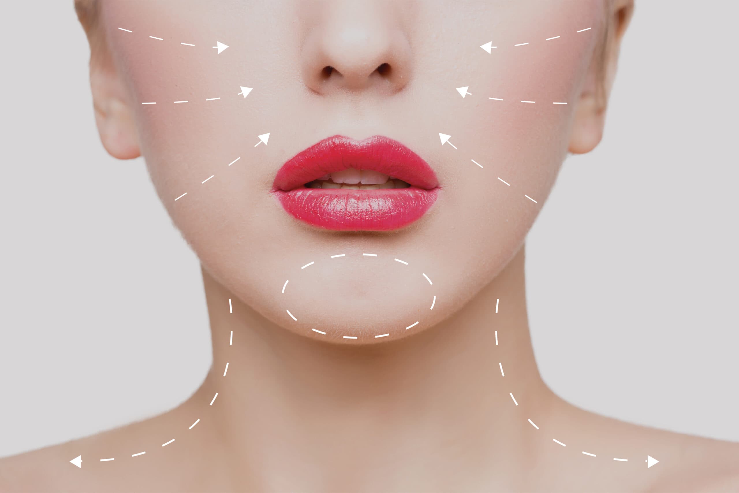 Botox spot