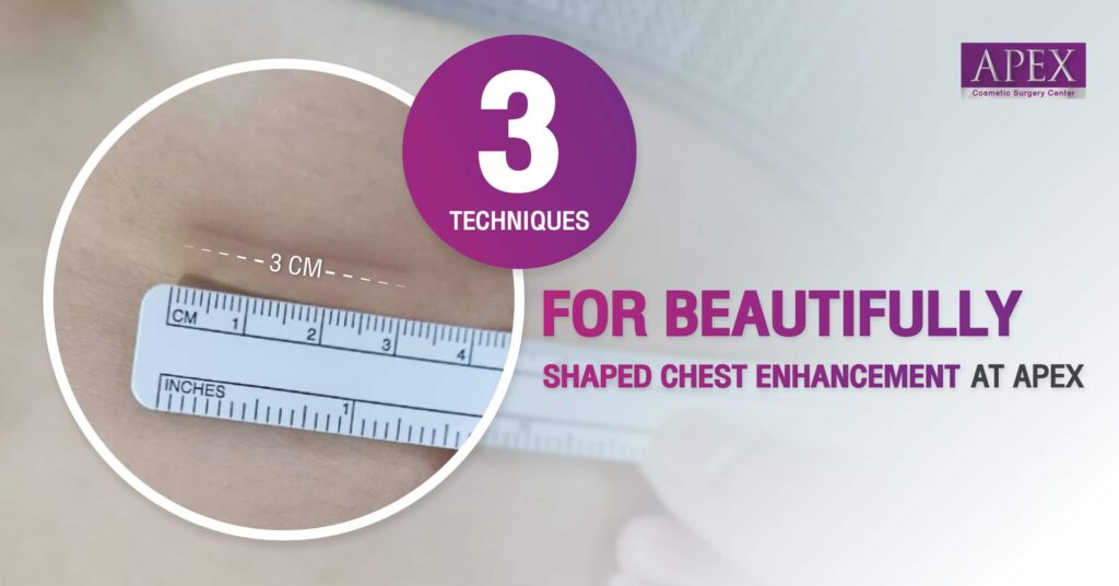 Breast augmentation
