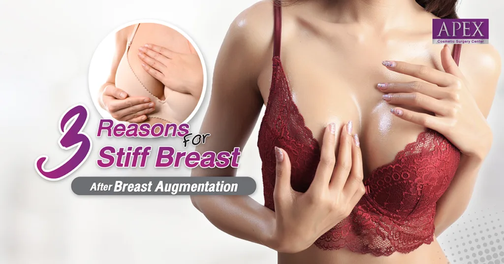 Breast Augmentation