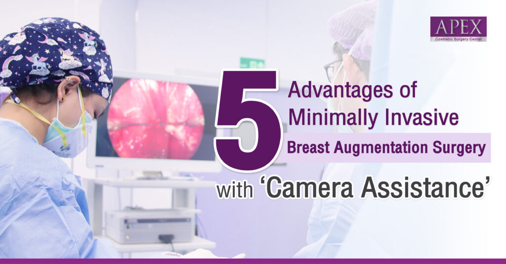 Breast augmentation