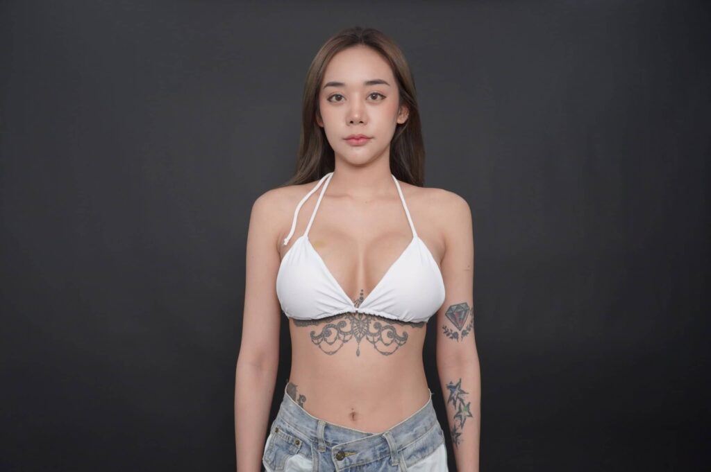 Breast augmentation review3