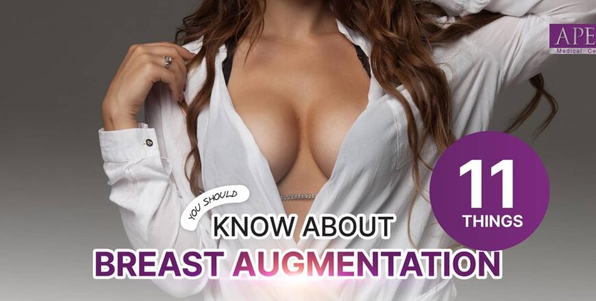 Breast augmentation