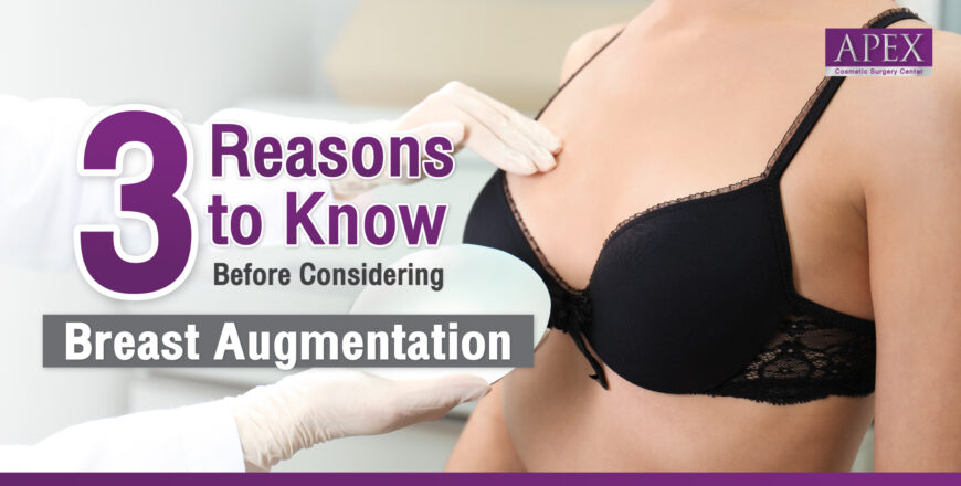 Breast augmentation