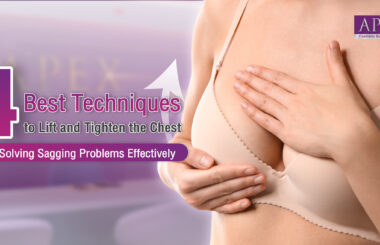 Breast augmentation