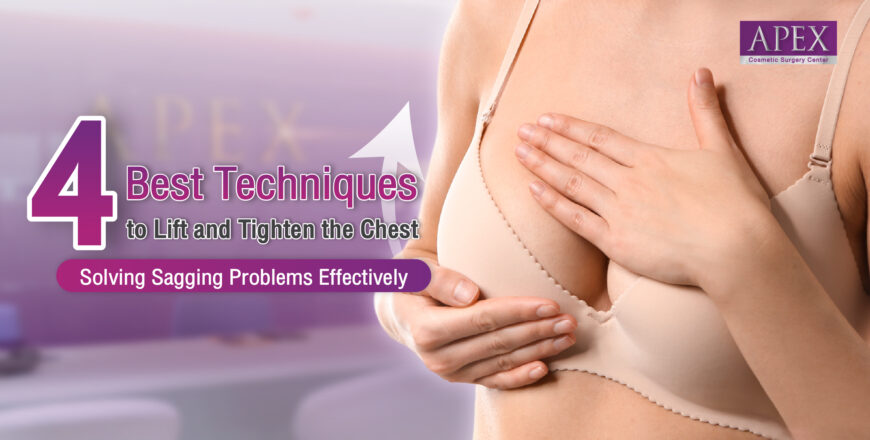 Breast augmentation