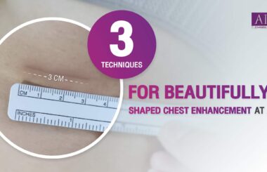 Breast augmentation