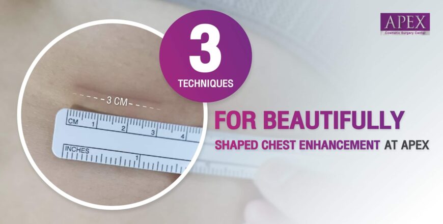 Breast augmentation