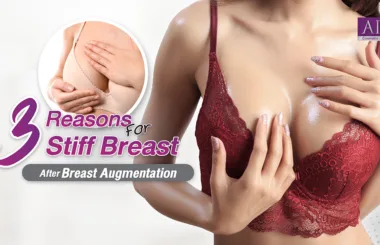 Breast Augmentation