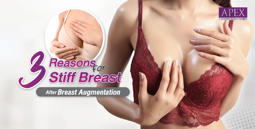 Breast Augmentation
