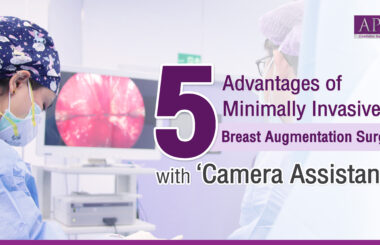 Breast augmentation