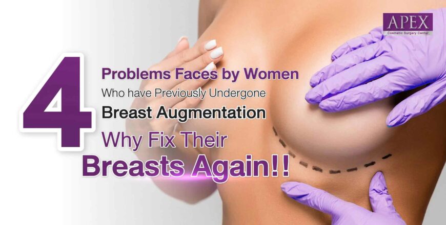 Why fix breasts again