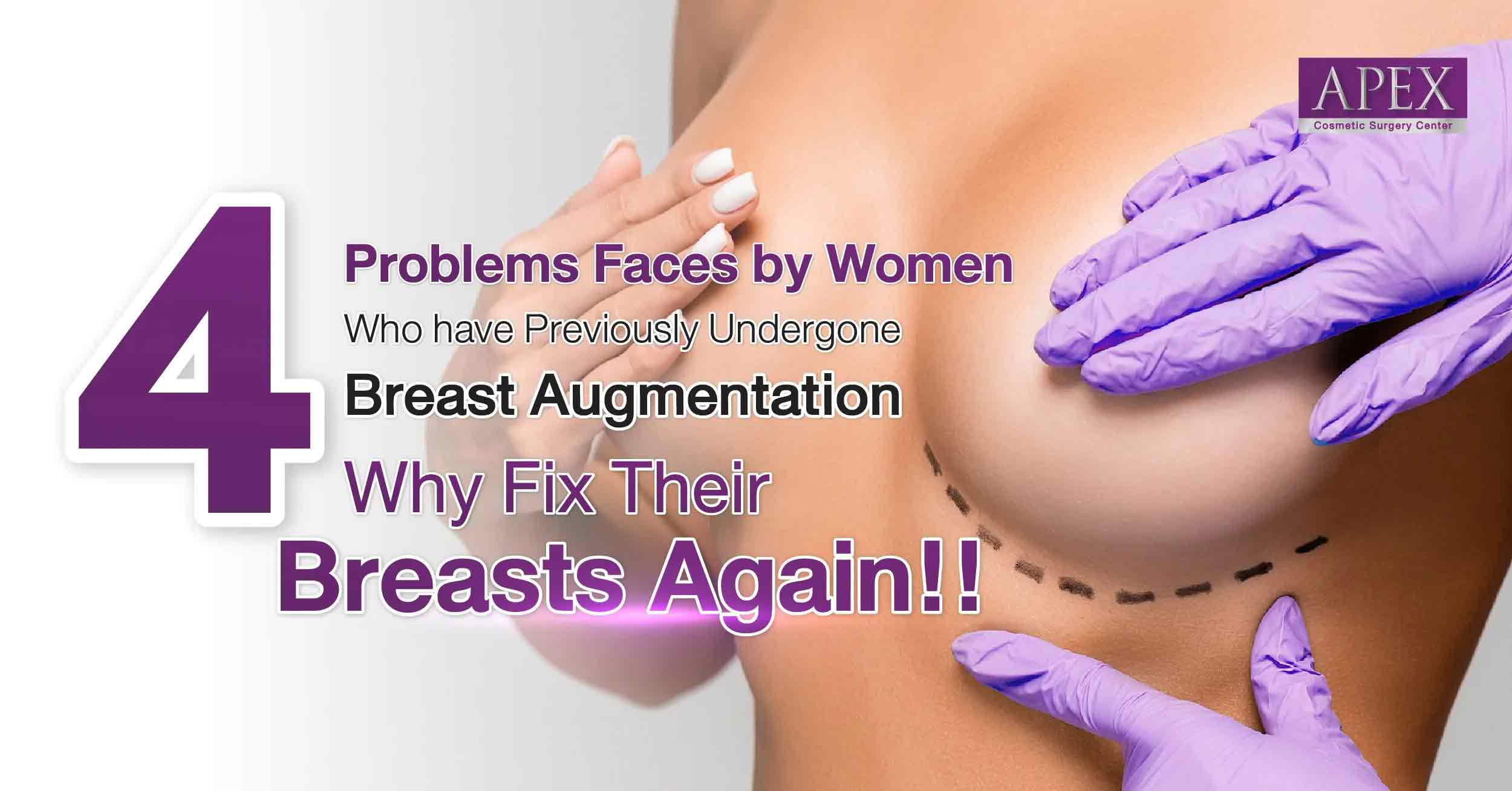Why fix breasts again