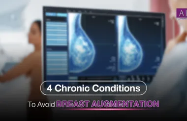 4 chronic