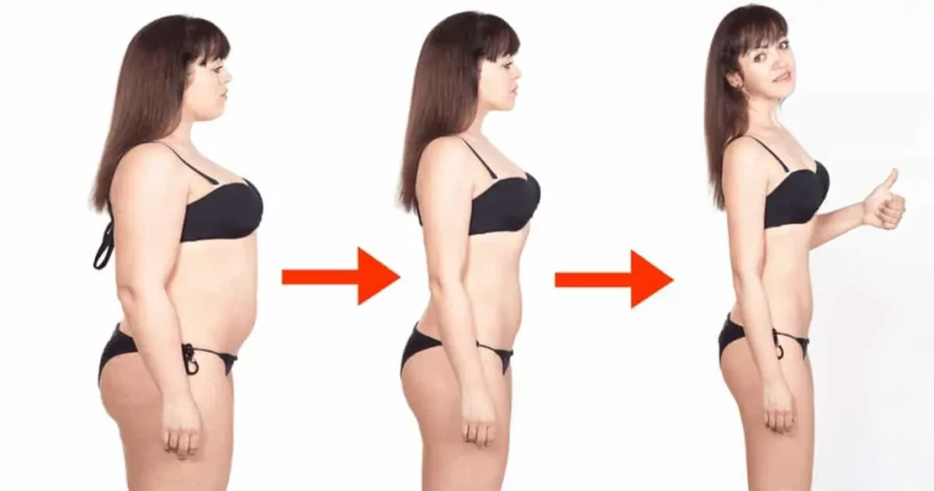 Liposuction Surgery