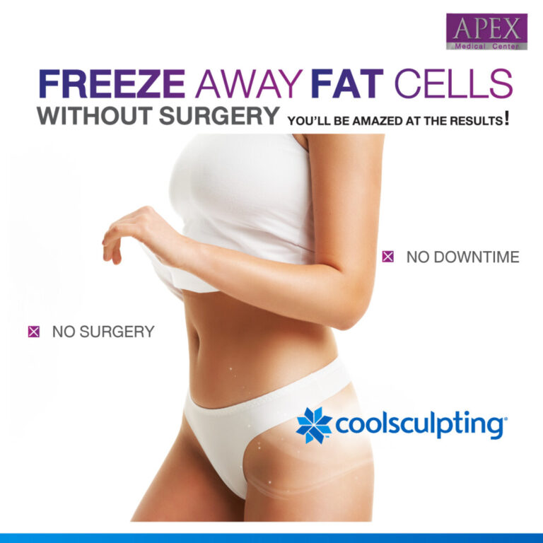 Coolsculpting.1